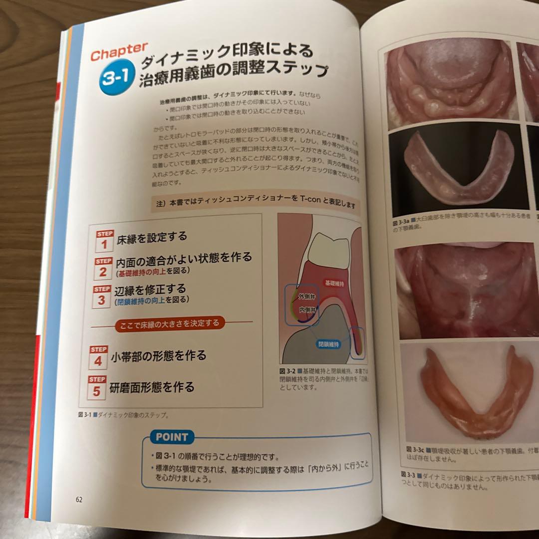 H H H　患者さんが総義歯を使いこなすためのトレーニング法と義歯調整法