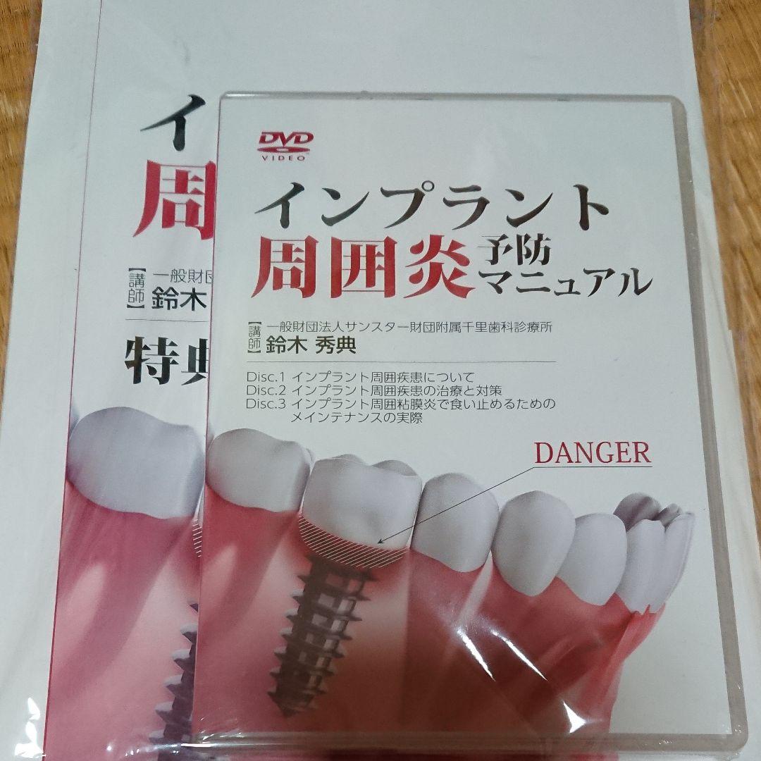 インプラント周囲炎 予防マニュアル