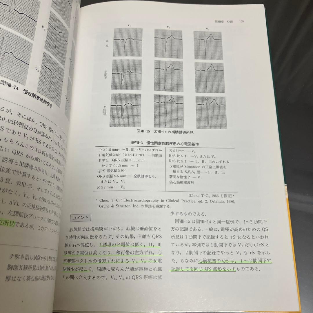 【絶版】異常波形の読み方 心電図鑑別のチェックポイント