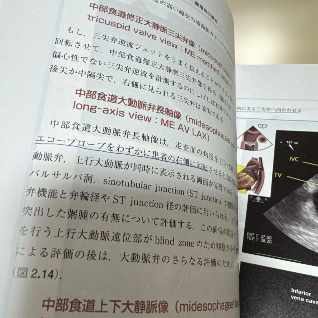 周術期経食道心エコー実践法　第4版