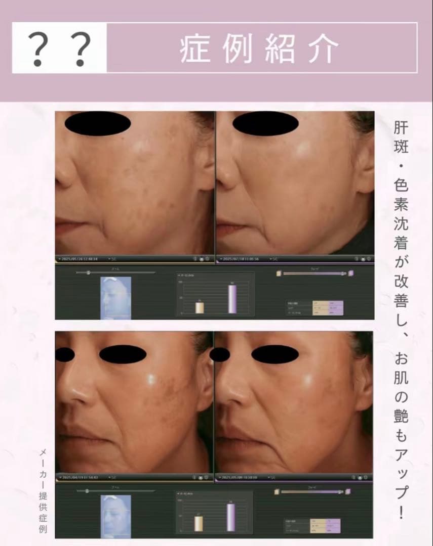 即発送いたします☺︎　高純度リジュラン×2 、ピンクグロー
