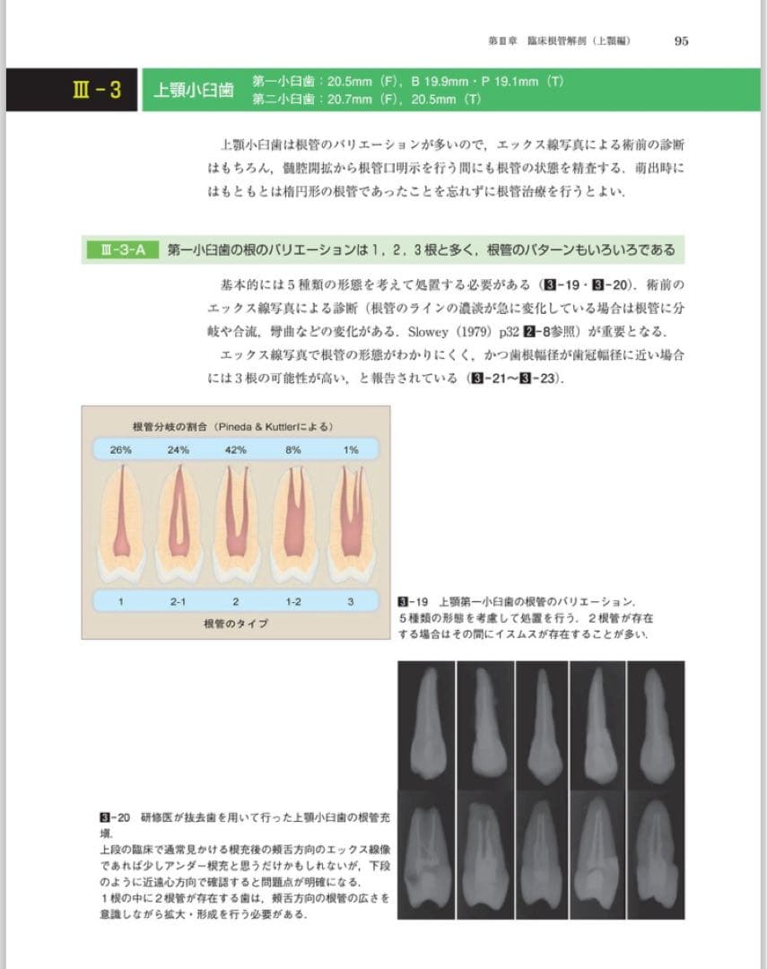 歯内療法 成功への道 臨床根管解剖: 基本的知識と歯種別の臨床ポイント