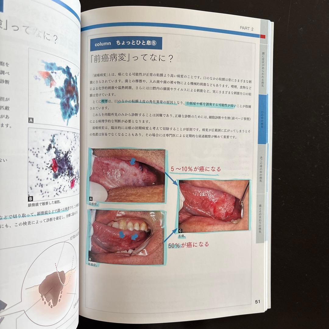 口腔がん,口腔がん検診Q&A かかりつけの歯医者さんにみてもらいましょう他2冊