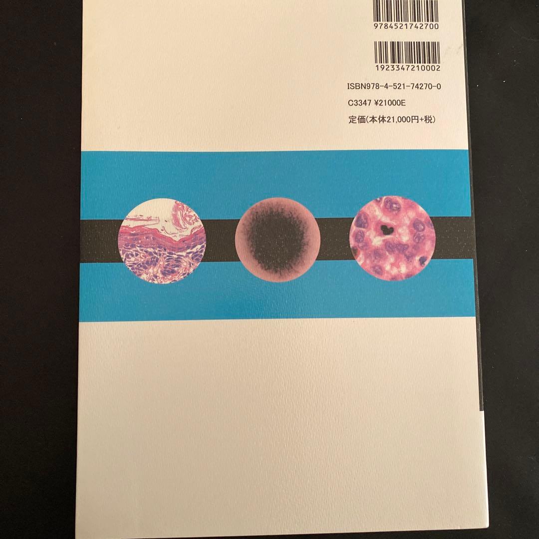 皮膚腫瘍
