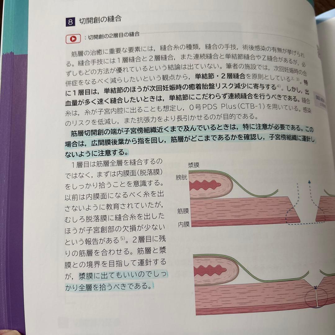 OGS NOW basic No.3 いきなり帝王切開術