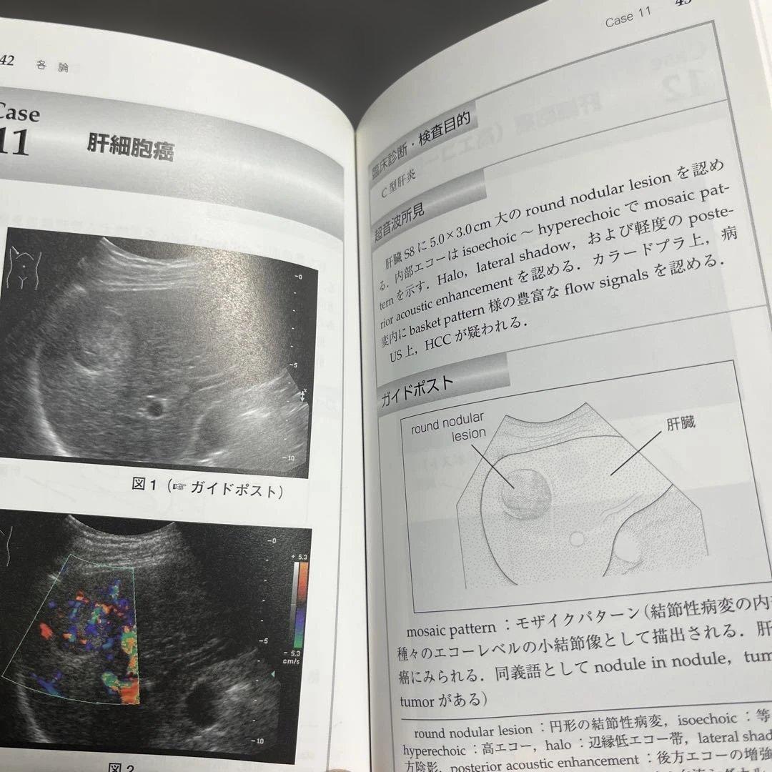腹部超音波検査レポート実例集