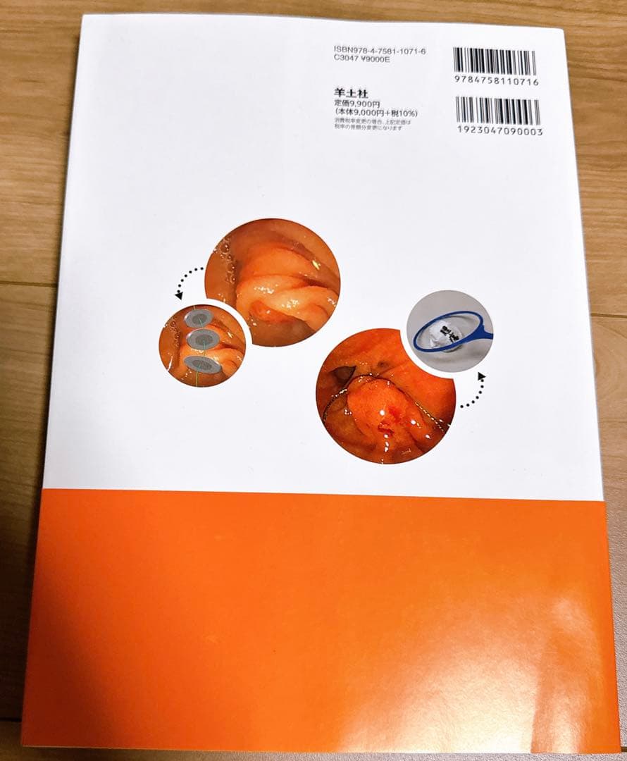 これで完璧!胆膵内視鏡の基本とコツ