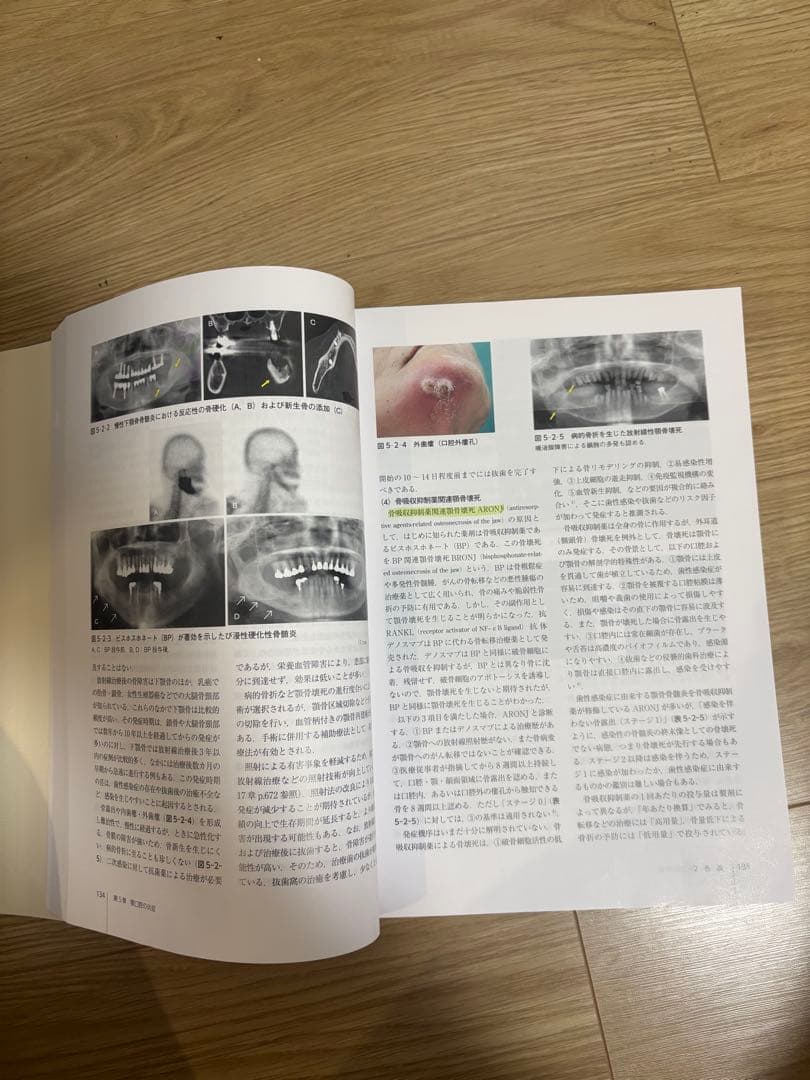 口腔外科学　第4版　医歯薬出版