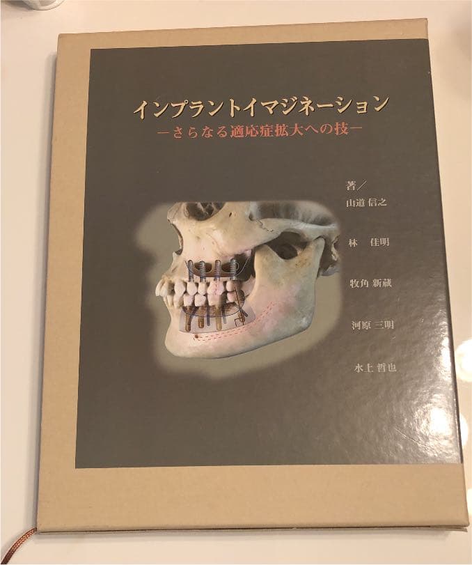 インプラントイマジネーション