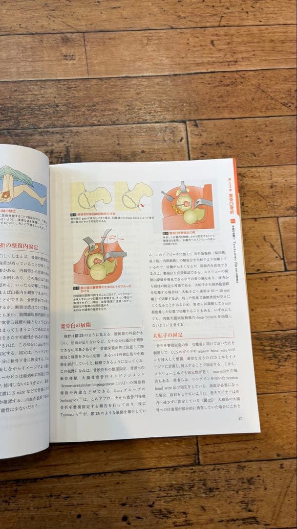 骨盤骨折　寛骨臼骨折・骨盤輪骨折の手術手技　整形外科