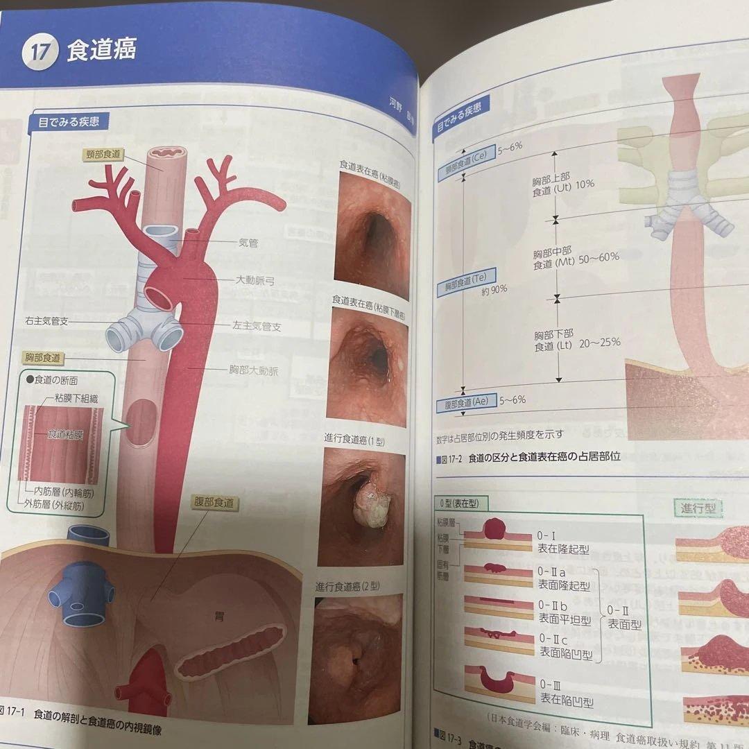 【第3版　症状別看護課程】【第4版　疾患看護課程】2冊セット➕おまけ