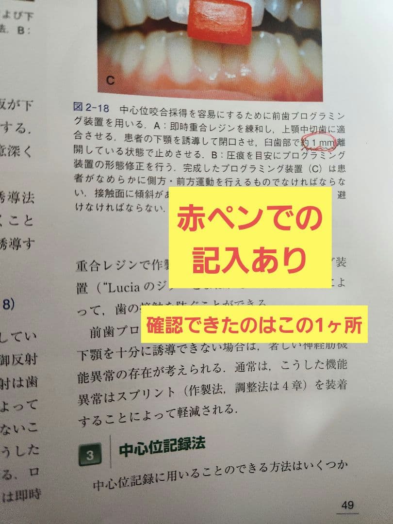 クラウンブリッジの臨床 第４版 医歯薬出版