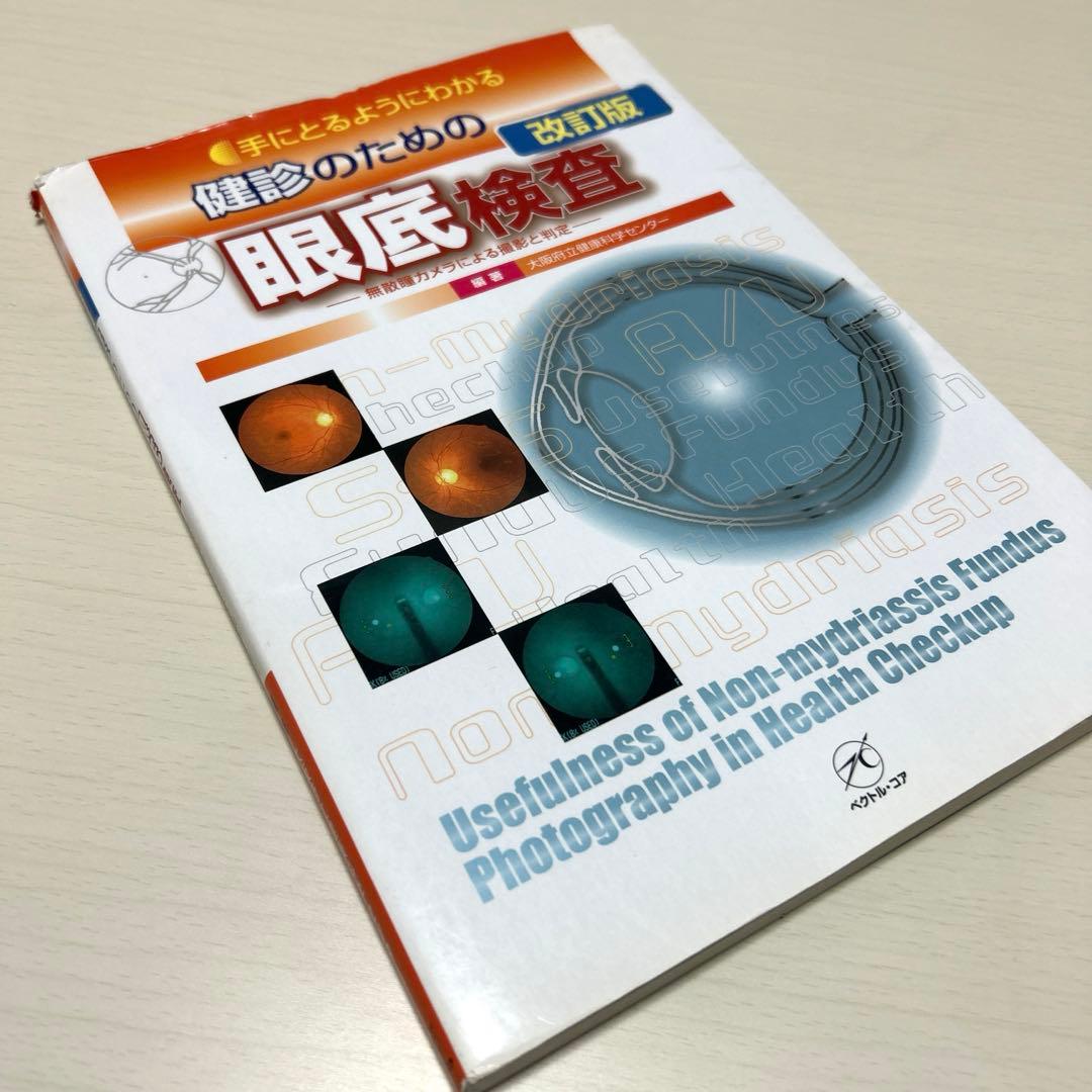 手にとるようにわかる健診のための眼底検査 無散瞳カメラによる撮影と判定 改訂版